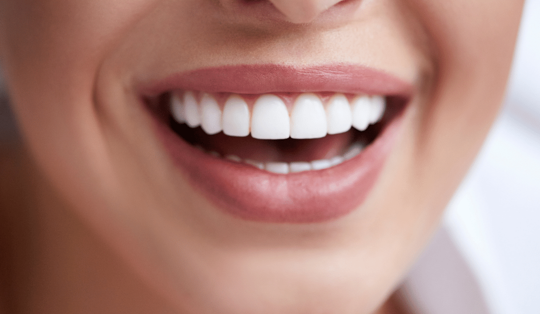 The Benefits of Whitening Your Teeth