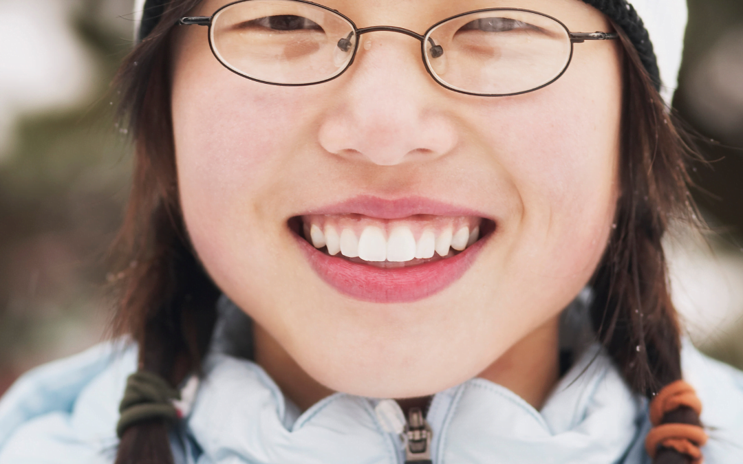 Teeth Whitening – Is It Safe for Teens?