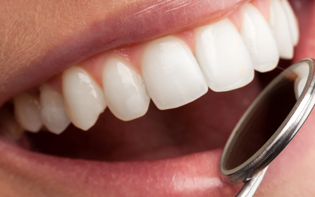 Use Your Dental Insurance Before the End of the Year